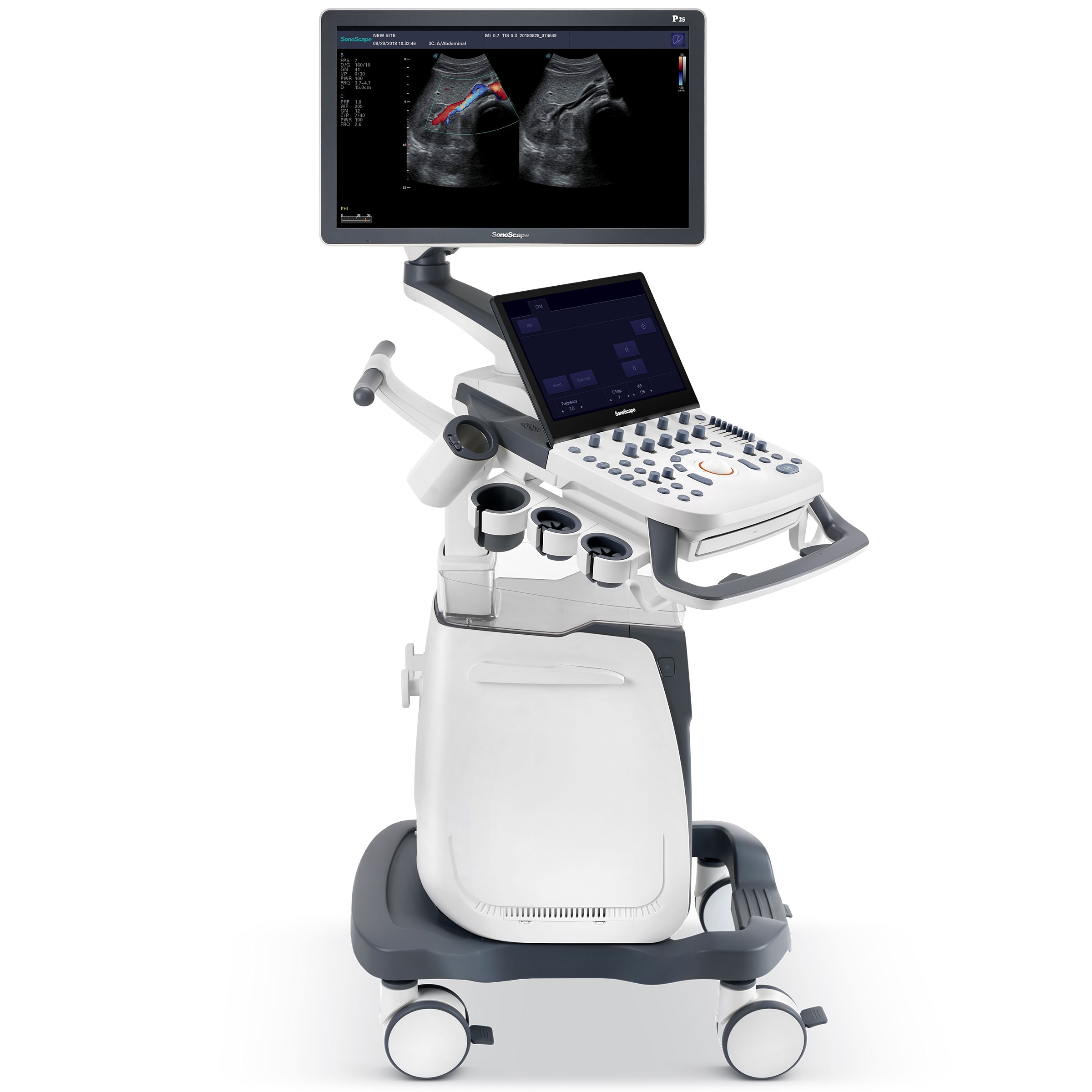 Máy siêu âm: (Doppler Tim – mạch máu, siêu âm ổ bụng, siêu âm tuyến giáp…)